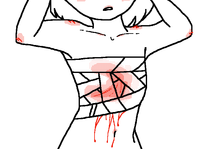 My Scars.. ( proportion practice )