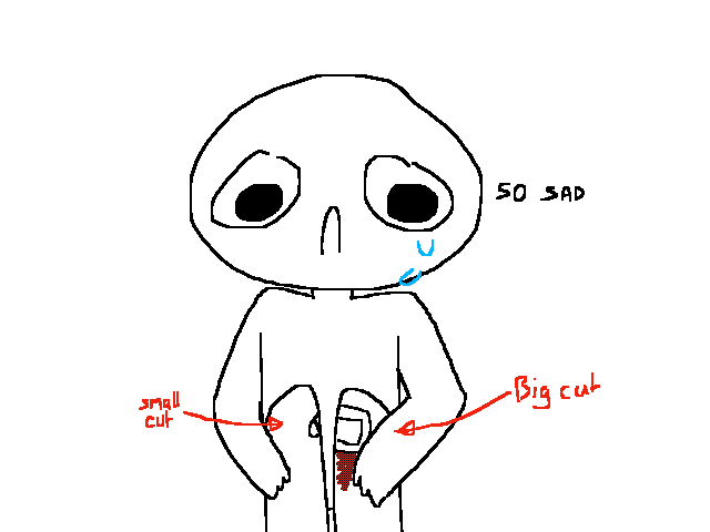 i cut my knees...fudge