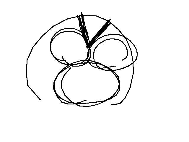 When someone u care about getting attacked