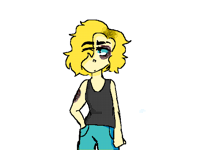 I have a black eye