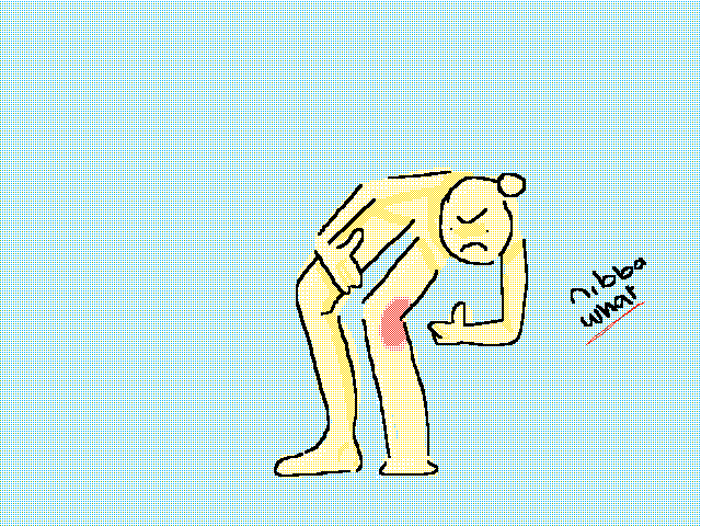 Got a big ass bruise on my leg