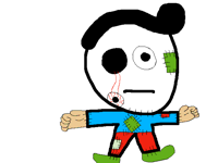 I went for woolen surgery