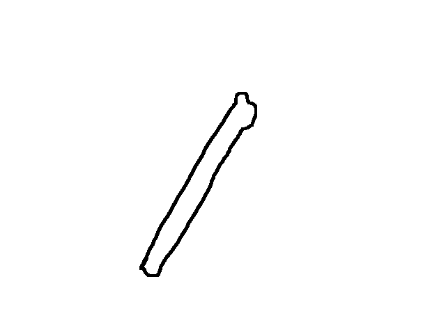 Bone