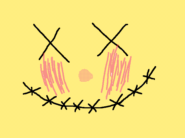 Race with Ryan bloody face