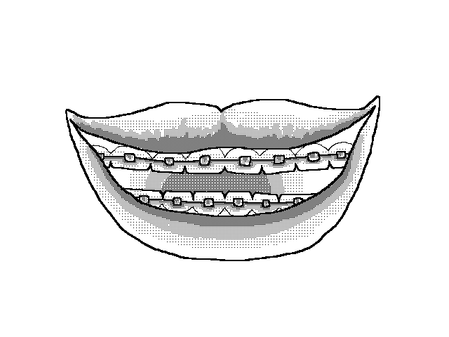 I wish my teeth were this straight