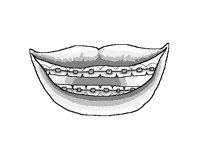 I wish my teeth were this straight