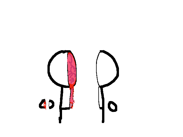 Anatomy