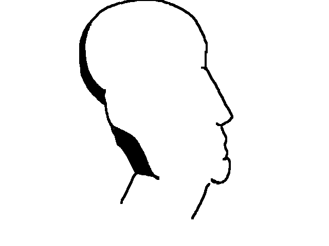 Head shit