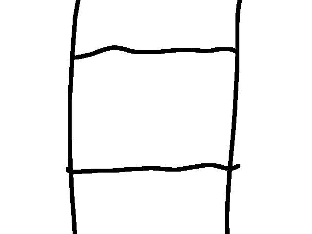 the dream I had last night