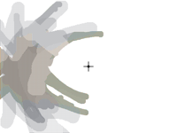 I think I’m having a migraine