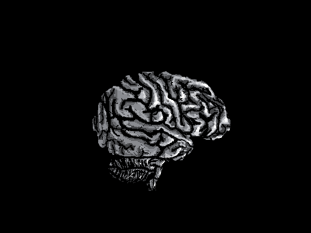 Brain spin