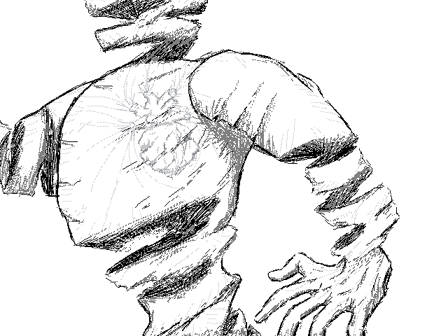 reconstruction body