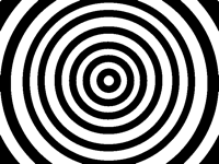 Epilepsy without epilepsy 3