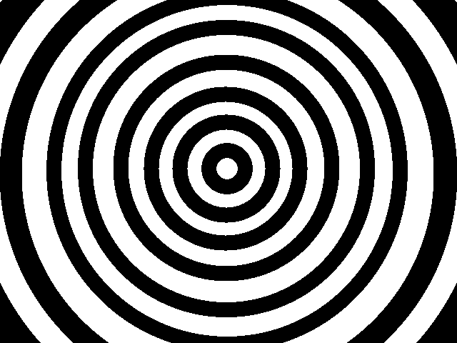 Epilepsy 3