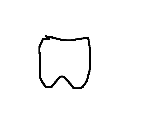 I just lost 2 teeth
