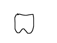 I just lost 2 teeth
