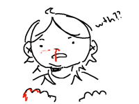 I got nosebleed