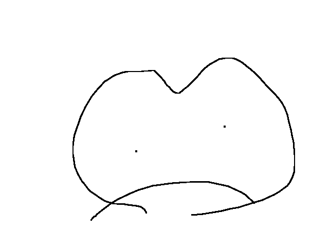 Im in so much pain omg