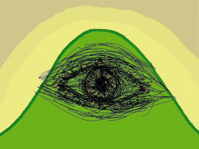 Eye