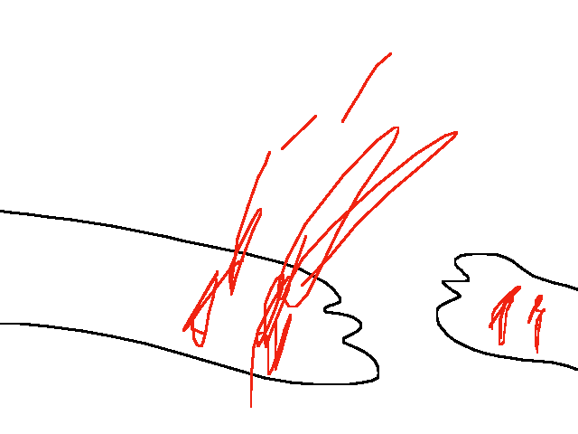 If u cut urself wouldnt it squirt everywhere
