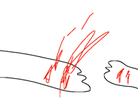 If u cut urself wouldnt it squirt everywhere