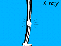 My knees is broken :( (realy)