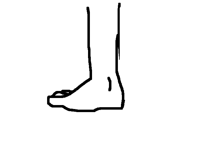 Foot. Ouch