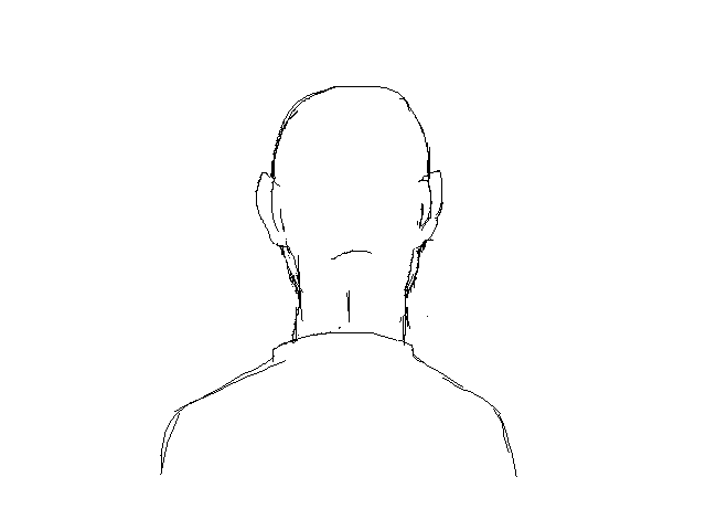 Head turn test