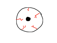 Eye