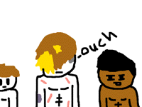 I got torn up when swimming