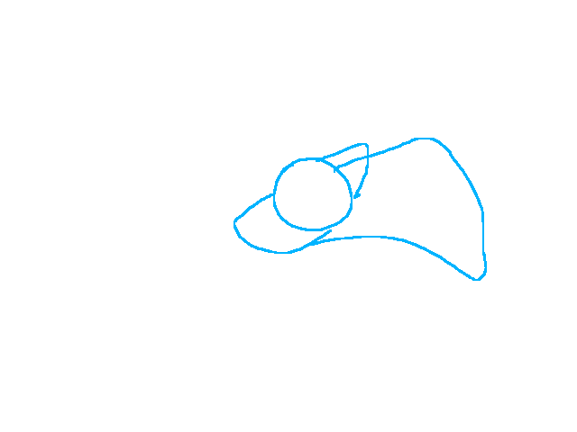 Lifting head