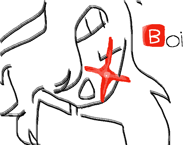 ️oi