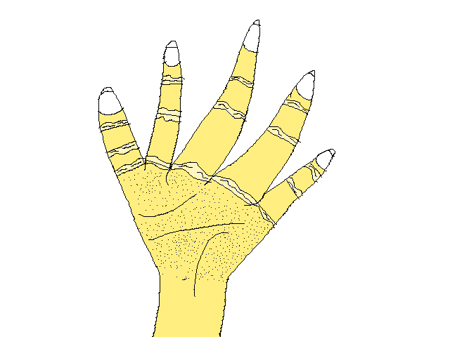 ARM