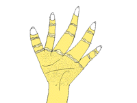 ARM